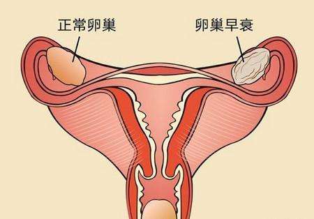 30岁女人保养卵巢应该怎么做？