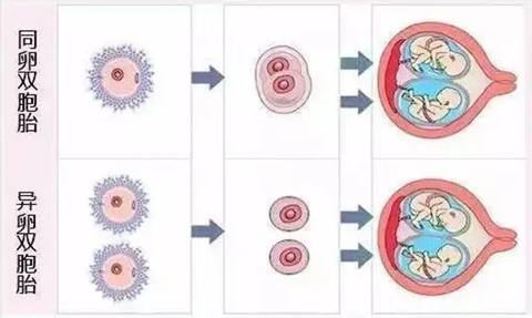 试管婴儿可以做单卵双胎吗？